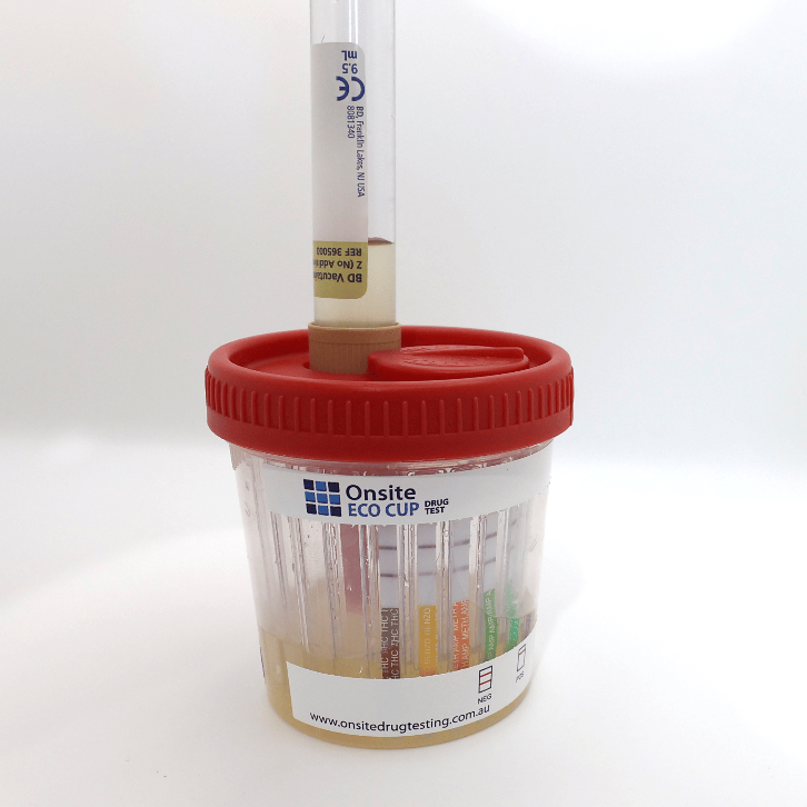 Vacuum tube and red lid on a clear Onsite Eco Cup urine drug test on a white background