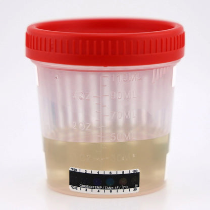 Onsite Eco 7 Advanced Urine Drug Test Cup Vacuum Lid (OD - 070A) - Onsite Diagnostics - Australian Drug Tests and Training - Urine Drug Test - Onsite Diagnostics