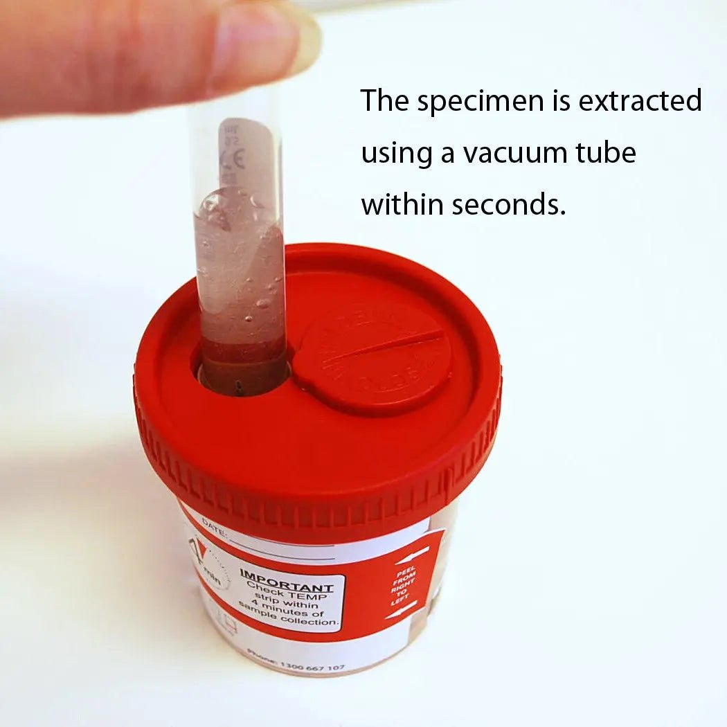 Onsite Eco 7 Advanced Urine Drug Test Cup Vacuum Lid (OD - 070A) - Onsite Diagnostics - Australian Drug Tests and Training - Urine Drug Test - Onsite Diagnostics